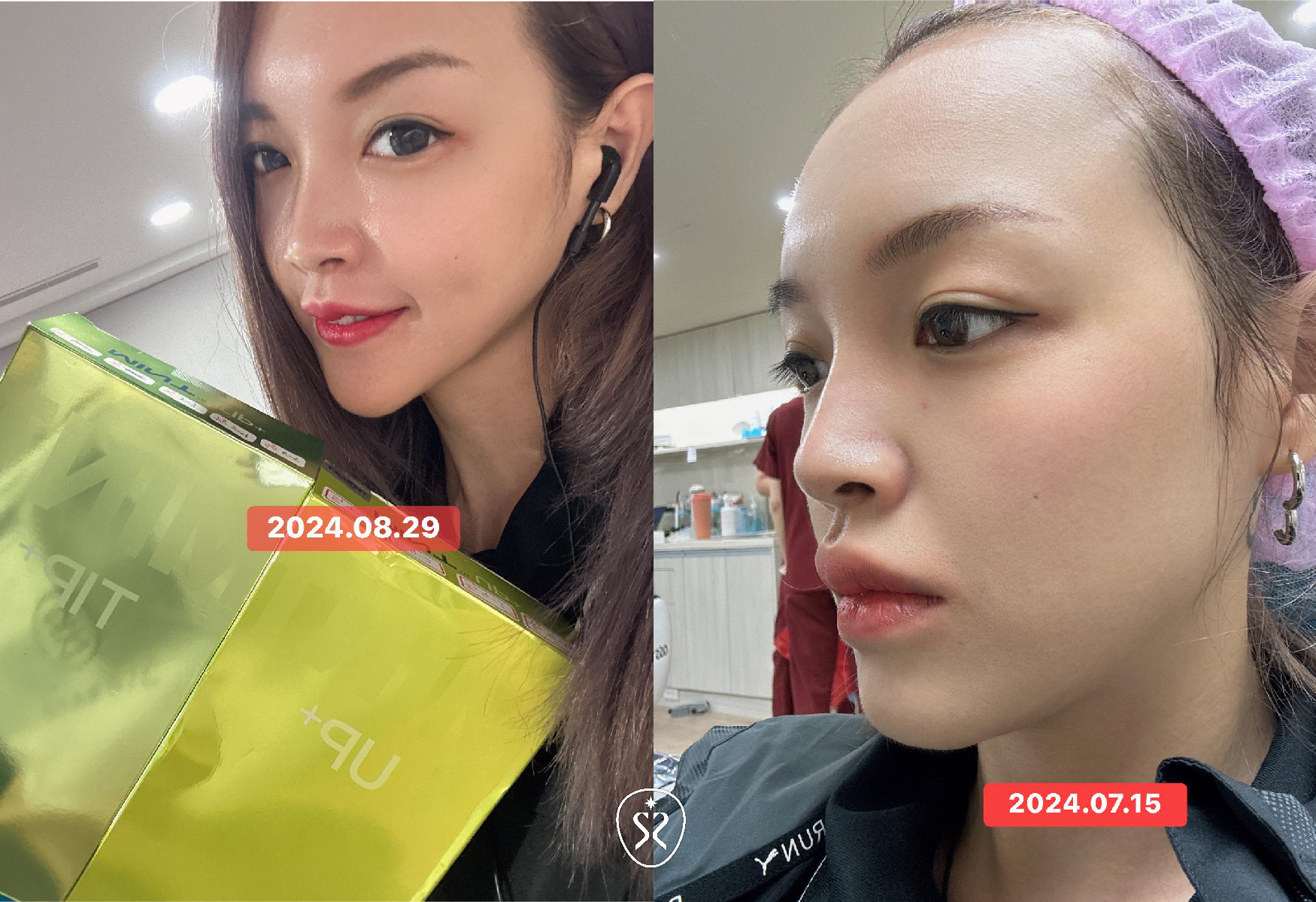MINT秘特拉提當中的UP及TIP短線可以針對鼻子進行調整